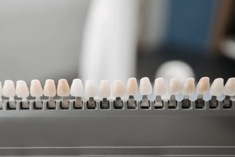 Best Veneers in Mexico: Your Guide to a Radiant Smile 5 Dental veneer shade samples displayed at Mexico dental clinic